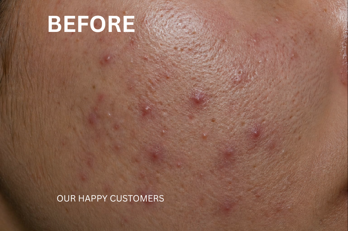Complete Skin Transformation Kit (4-Step Routine)