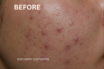 Complete Skin Transformation Kit (4-Step Routine)