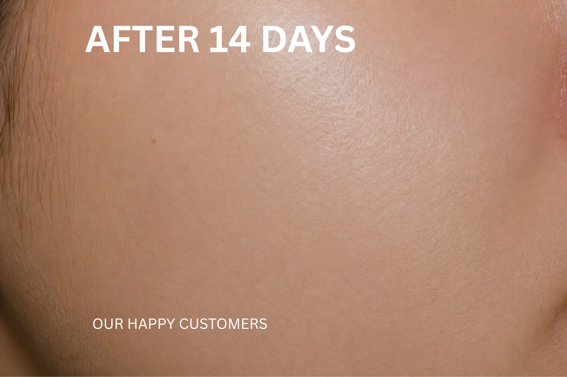 Complete Skin Transformation Kit (4-Step Routine)